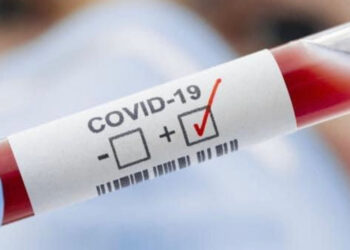 Шымкентте 444 адамнан қауіпті індет анықталды