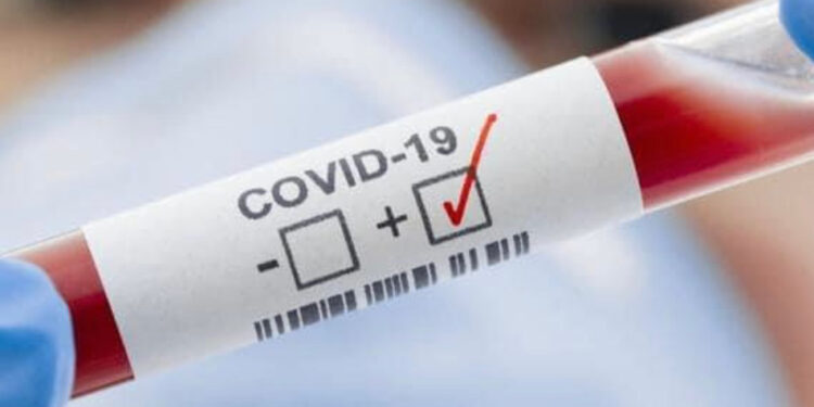 Шымкентте 444 адамнан қауіпті індет анықталды