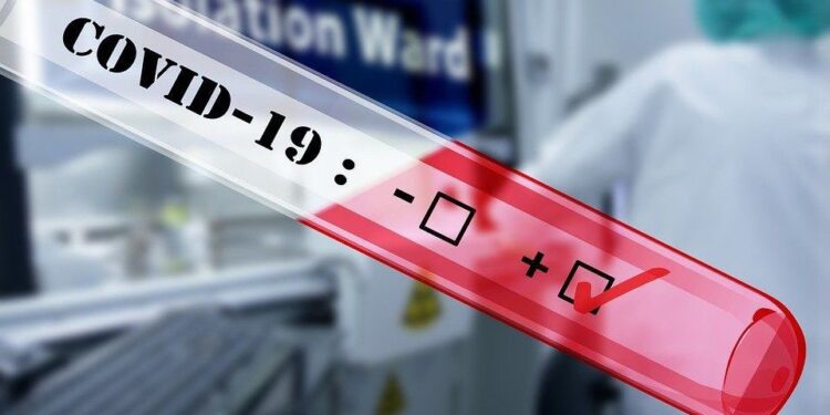 Өткен тәулікте 157 адамнан коронавирус анықталды