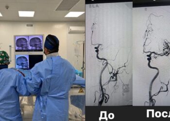 ТҮРКІСТАНДА АЛҒАШ РЕТ ИШЕМИЯЛЫҚ ИНСУЛЬТҚА ТРОМБОЭКСТРАКЦИЯ ОТАСЫ ЖҮРГІЗІЛДІ