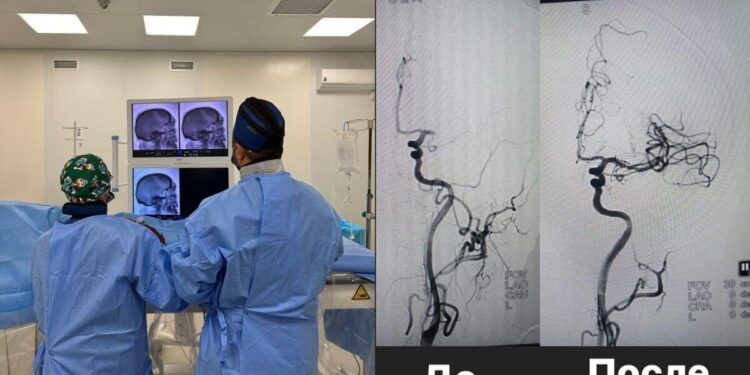 ТҮРКІСТАНДА АЛҒАШ РЕТ ИШЕМИЯЛЫҚ ИНСУЛЬТҚА ТРОМБОЭКСТРАКЦИЯ ОТАСЫ ЖҮРГІЗІЛДІ