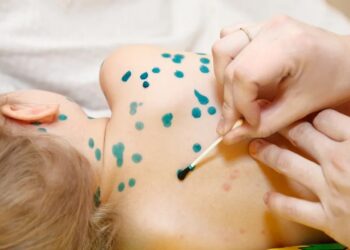 ТҮРКІСТАН ТӨҢІРЕГІНДЕ ҚЫЗЫЛША ДЕНДЕП ТҰР