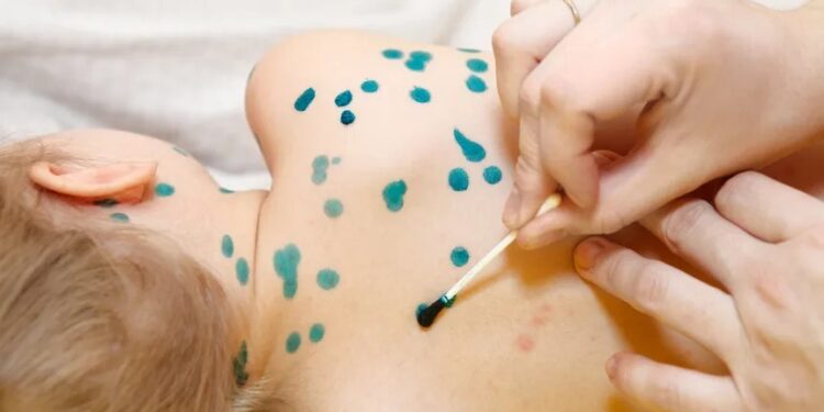 ТҮРКІСТАН ТӨҢІРЕГІНДЕ ҚЫЗЫЛША ДЕНДЕП ТҰР